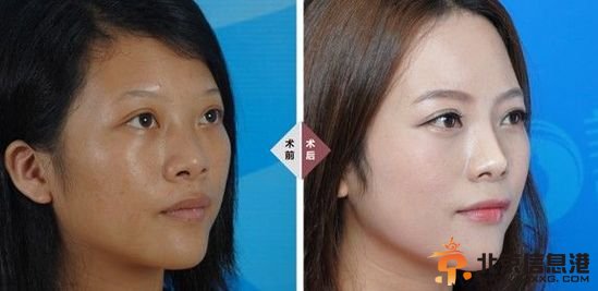 卓琳妹妹简历微博曝光 东莞女工模特卓琳艺术照