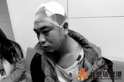 受伤的创新物业员工。