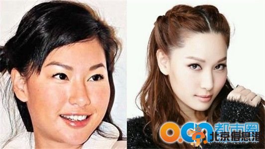 my盛lady徐子珊整容前后照片对比 徐子珊整容前的样子