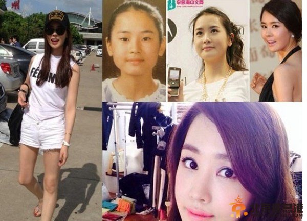 酒店之王李多海整容过度被吐槽 吓傻观众