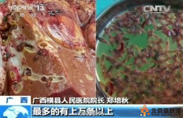 淡水鱼生鱼片有上万条肝吸虫引发肝癌 专家：最好不要吃【图】