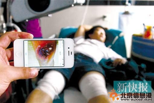 东莞一快递员投送货物时被残留化学液体烧伤膝盖(图)