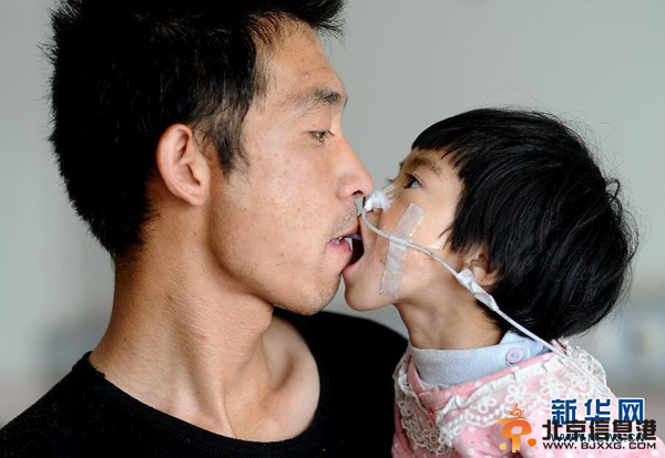 父亲嘴对嘴为患病女儿喂食 坚持500多天(图)