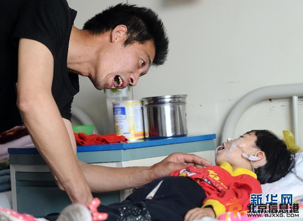 父亲嘴对嘴为患病女儿喂食 坚持500多天(图)