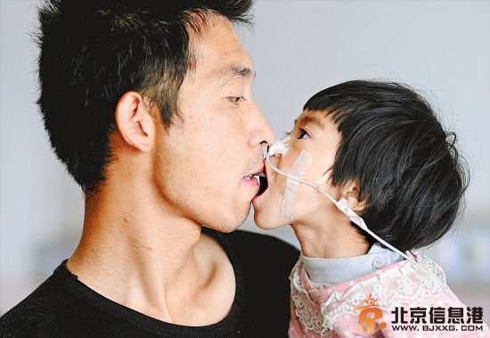 父亲嘴对嘴喂食女儿网友质疑 口腔不卫生应做成泥