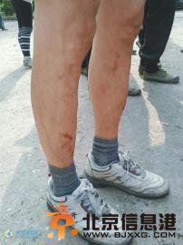 点击进入下一页