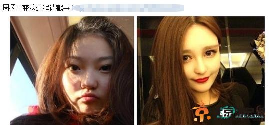 网友曝疑似罗志祥女友整容前后