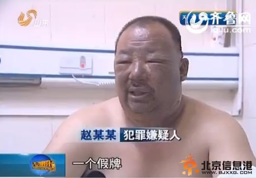 民警找到犯罪嫌疑人时，他正在医院烧伤科接受治疗。