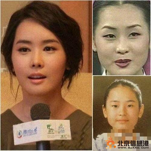 曝韩国女星整容变脸对比照(组图) 