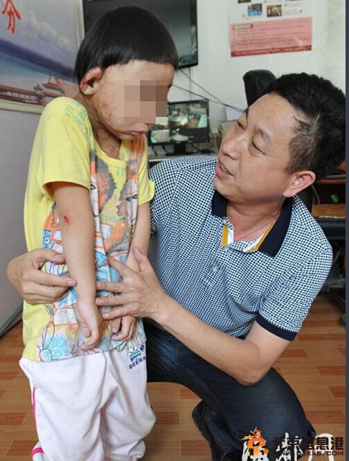 5岁男童被母反锁1年 靠喝饮料为生 