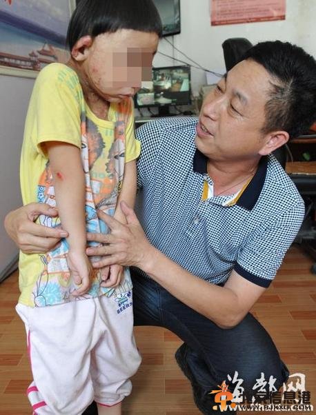 莆田五龄童被吸毒母反锁 一年多时间只喂饮料