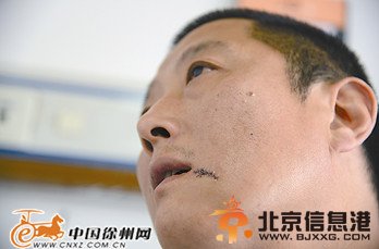 网逃嫌疑人甩棍攻击便衣民警 