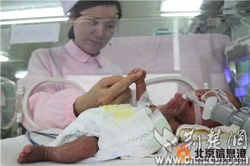 湖北最轻早产儿成活 出生时仅500克身高像圆珠笔