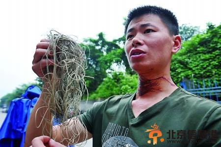 男子骑车遭风筝线划破喉咙 锋利程度可切树枝鲜肉