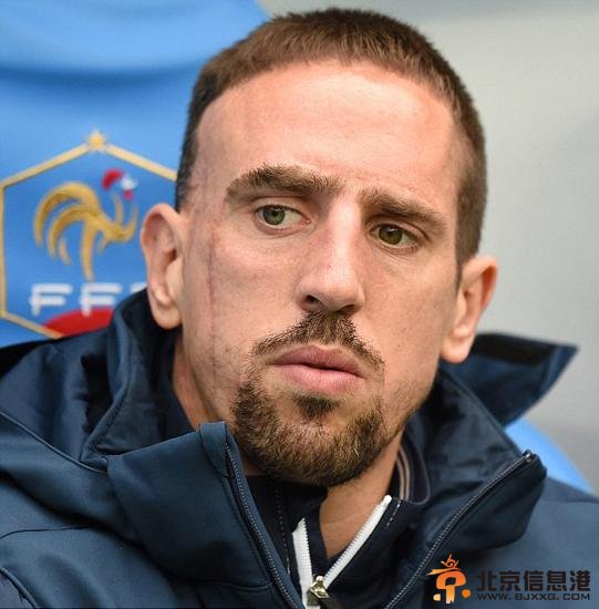 里贝里恐因伤缺席世界杯 背部疼的站不起来