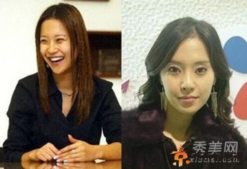 韩国女星假脸走天下 20大女星整容对比照判若两人