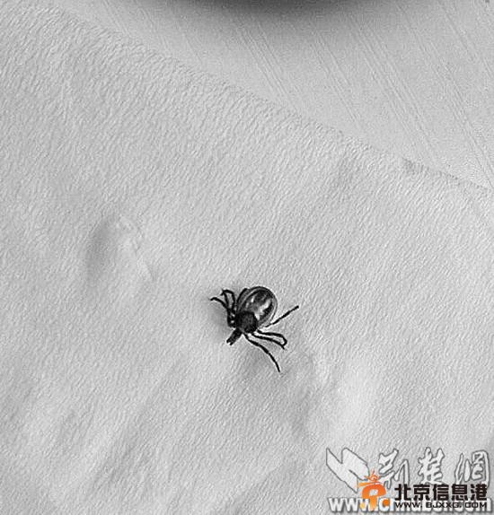 武汉女子遭吸血蜱虫“附体” 女白领被迫挖肉取虫(图) 