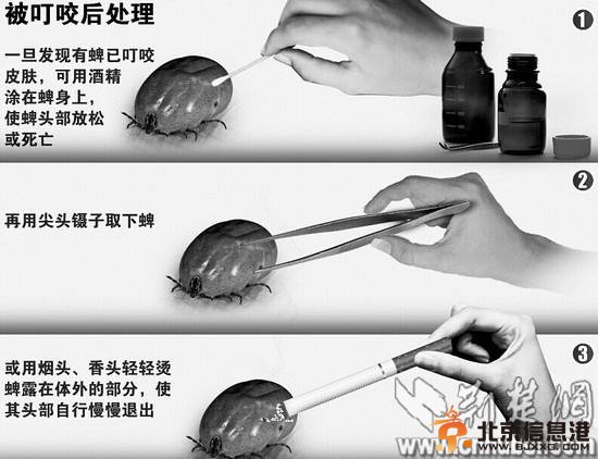 武汉女子遭吸血蜱虫“附体” 女白领被迫挖肉取虫(图) 