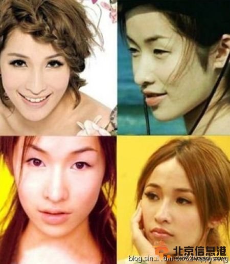 超女王梓高调宣布为事业整容 盘点公开承认整容的女星【图】