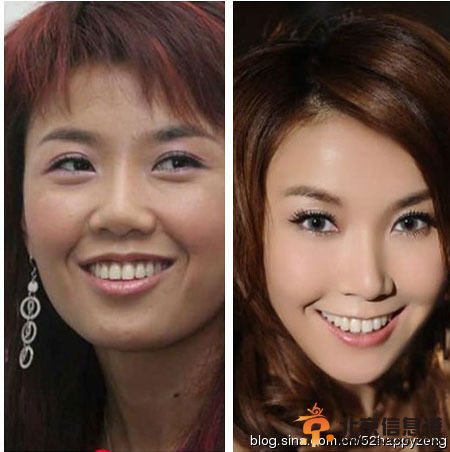 超女王梓高调宣布为事业整容 盘点公开承认整容的女星【图】