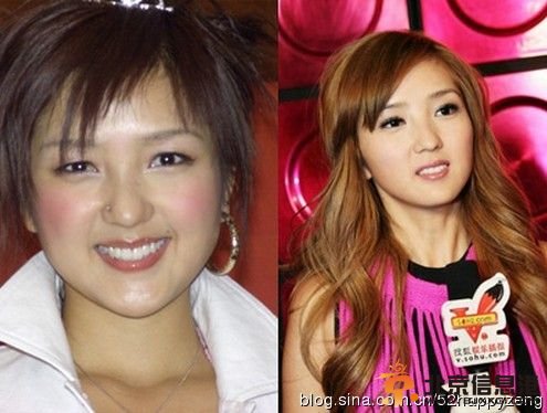 超女王梓高调宣布为事业整容 盘点公开承认整容的女星【图】