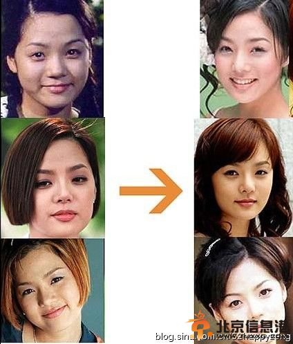 超女王梓高调宣布为事业整容 盘点公开承认整容的女星【图】