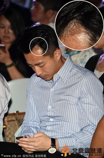 汪小菲接近秃顶害怕污染暂不会让大S女儿回京