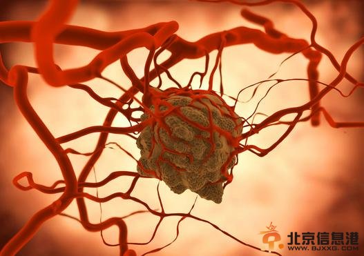 人类饿死癌细胞副作用可能似化疗 清华大学并非此概念首提