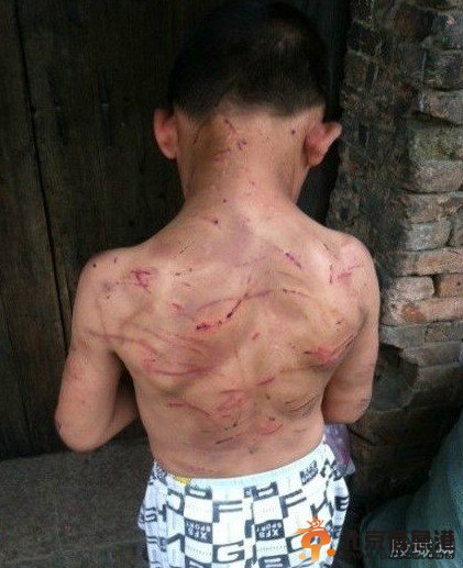 男童被母剪耳朵