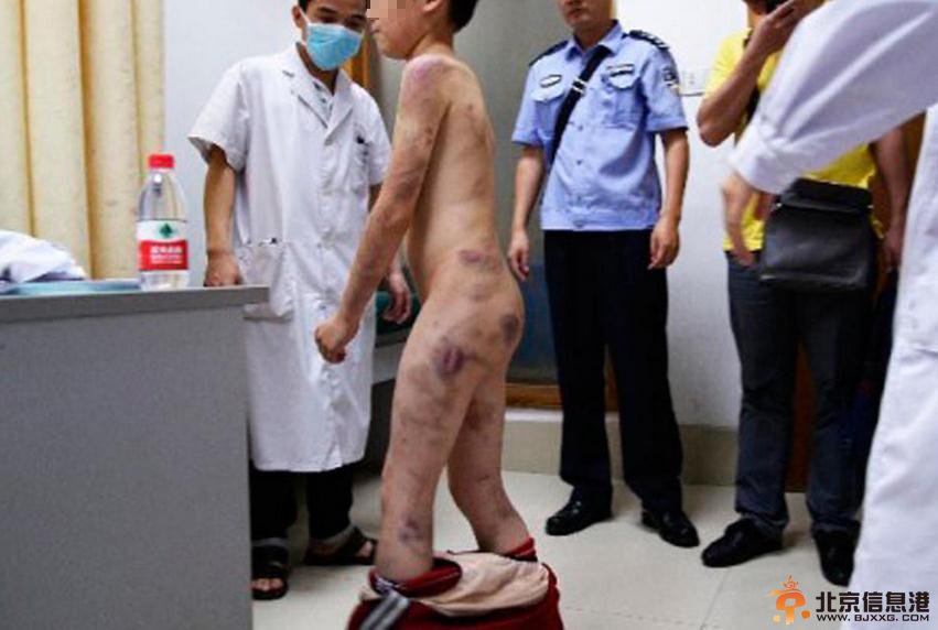 男童被母剪耳朵 盘点那些令人发指的虐童事件【组图】
