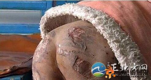 男童被母剪耳朵 盘点那些令人发指的虐童事件【组图】