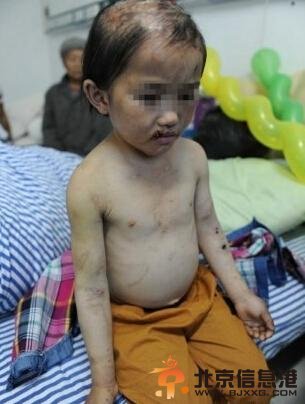 男童被母剪耳朵 盘点那些令人发指的虐童事件【组图】