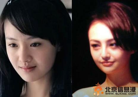 郑爽整容后张翰惊呆 李菲儿当小三插足张翰变心【组图】