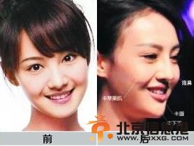 郑爽整容后张翰惊呆 李菲儿当小三插足张翰变心【组图】