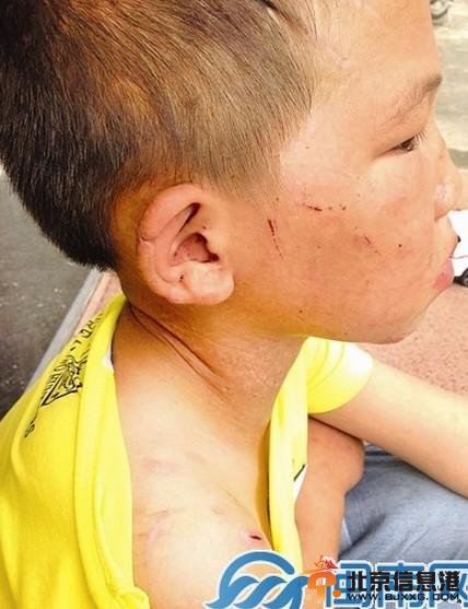 福建莆田男童被母剪耳朵 全身满是伤痕触动众人心