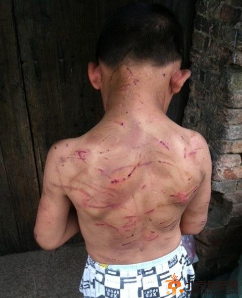 男童被母剪耳朵满身划痕 村民看9岁小龙到处流浪还不如弃婴岛孩子幸福