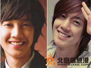 金贤重资料及金贤重整容前后对比照