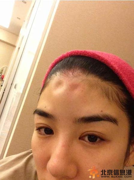 黄奕提出离婚否认出轨 微博晒丈夫家暴被打照片