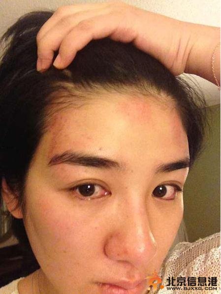 黄奕提出离婚否认出轨 微博晒丈夫家暴被打照片