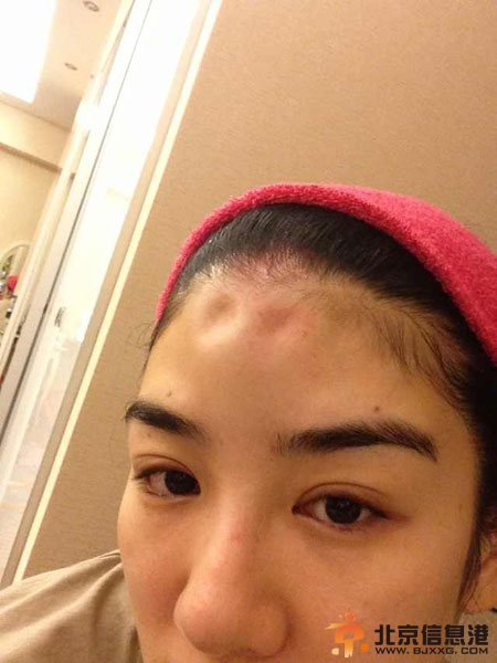 黄奕晒家暴照夺女抚养权 黄毅清多次酒店偷腥有图有证据