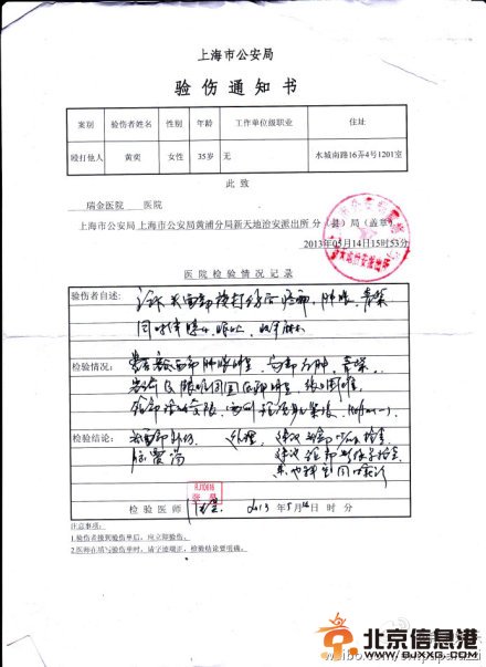 黄奕家暴是真是假 黄奕被老公黄毅清家暴证据揭秘