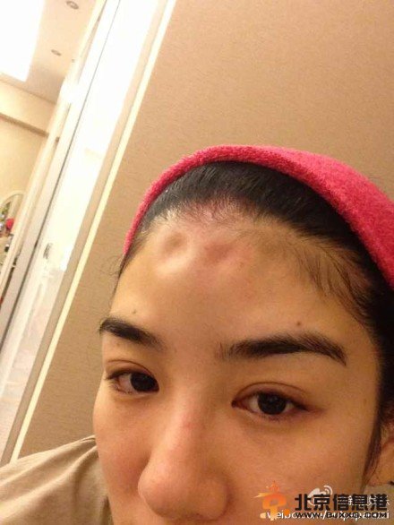 黄奕家暴是真是假 黄奕被老公黄毅清家暴证据揭秘