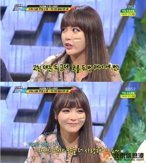 《我们结婚了》洪真英自爆曾整容3次 不怕老公南宫民嫌弃