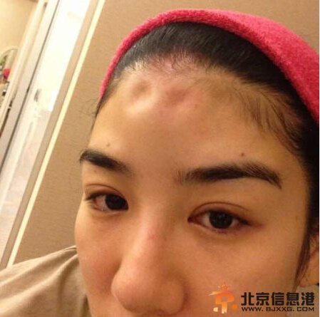 黄奕提出离婚刊登家暴照片遭大脸 黄毅清：打玻尿酸伪造伤处