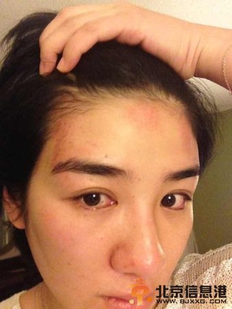 黄奕晒出家暴照片