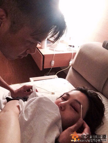 范玮琪上厕所被摔毁容照片 满脸鲜血缝20针