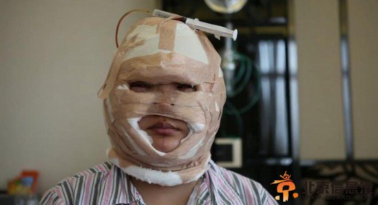 “超女”王梓整容视频流出 大方承认