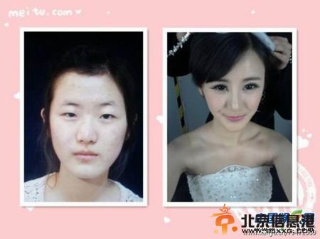 车模自曝整容变脸惊人照 网友评：又一个杨幂