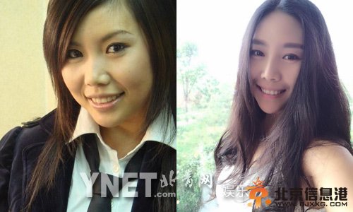 超女纪敏佳疑整容 颧骨磨平变锥脸女神(图)