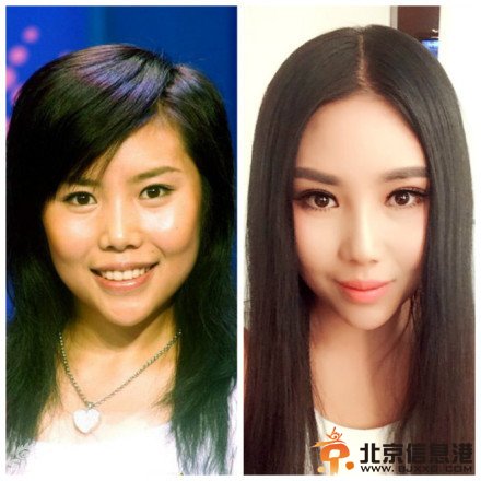 纪敏佳整容前后对比照:大饼脸一秒钟变女神【图】